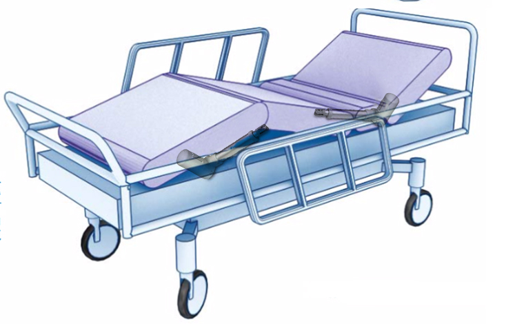 醫(yī)療電動(dòng)推桿 醫(yī)療電動(dòng)推桿